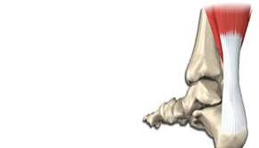 Bolest Achillovy šlachy